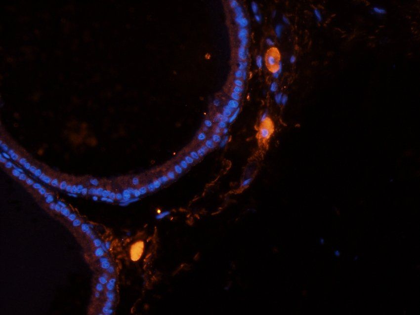 ATP1A2 antibody