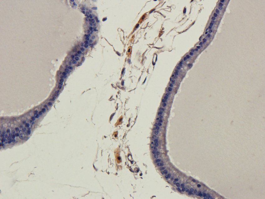 ATP1A2 antibody