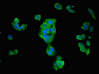 ATP1B1 Antibody