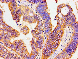 ATP1B1 Antibody