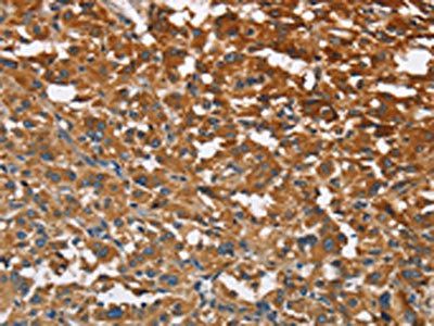 ATP1B2 Antibody