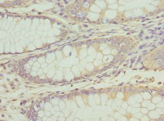 ATP2B2 Antibody