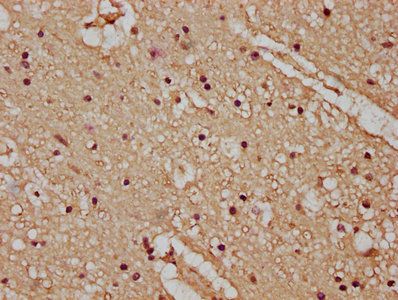 ATP2B4 Antibody