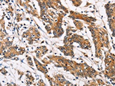 ATP2C1 Antibody
