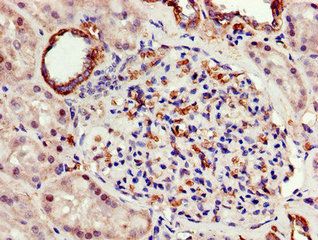 ATP5F1A Antibody