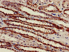 ATP5B Antibody