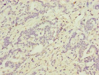 ATP5F1D Antibody