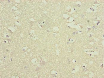 ATP5F1D Antibody