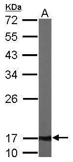 ATP synthase F1 subunit delta Antibody