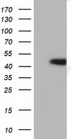ATP5F1B Antibody