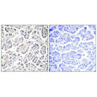 ATP5G3 Antibody