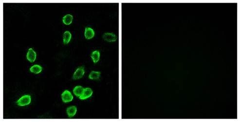 ATP5G3 Antibody