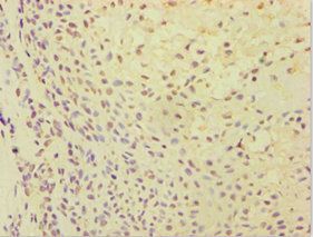 ATP5J Antibody