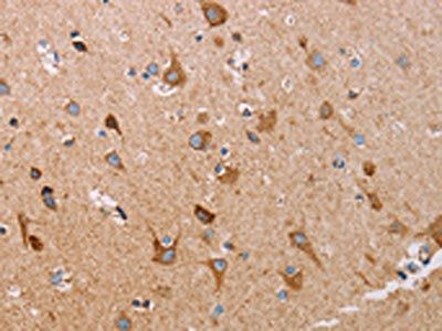 ATP5J Antibody