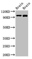 ATP6V0A1 Antibody
