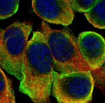 ATP6V0A2 antibody