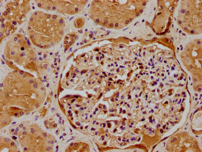 ATP6V0D2 Antibody