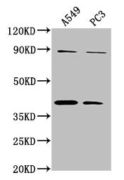 ATP6V0D2 Antibody