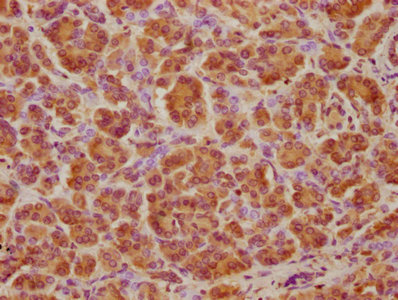 ATP6V1A Antibody