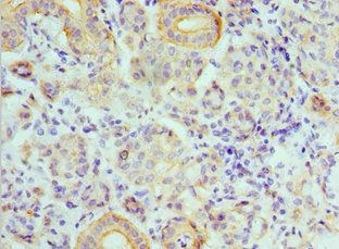 ATP6V1B1 Antibody