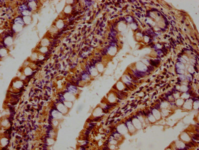 ATP6V1C1 Antibody