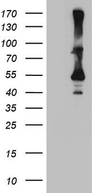 ATP6V1C2 Antibody
