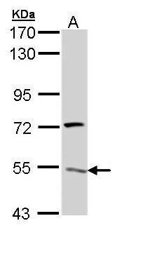 ATP6V1H antibody