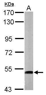 ATP6V1H antibody