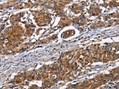 ATP7A Antibody