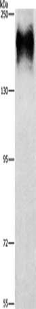 ATP7A Antibody