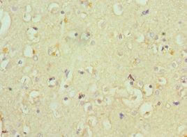 ATP7B Antibody