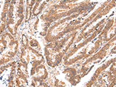 ATP7B Antibody