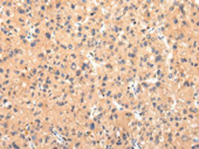 ATP7B Antibody