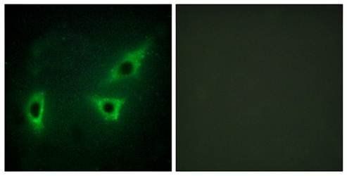 ATP7B Antibody