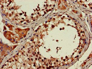 ATP9A Antibody