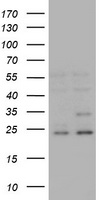 ATRIP Antibody