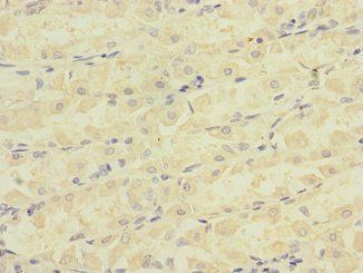 ATRN Antibody