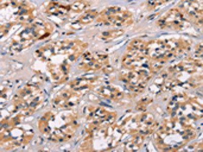 ATRN Antibody