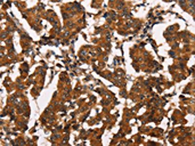 ATRN Antibody