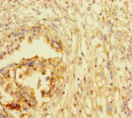 ATRX Antibody