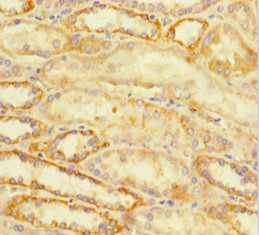 ATRX Antibody