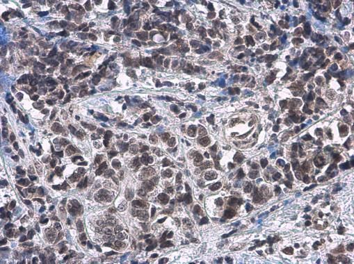 ATRX antibody [C3], C-term
