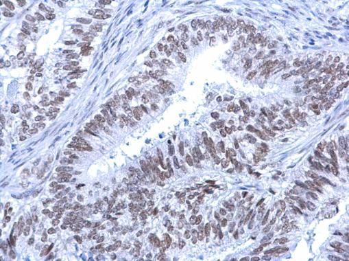 ATRX antibody [C3], C-term