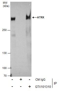 ATRX antibody
