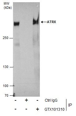 ATRX antibody [C3], C-term