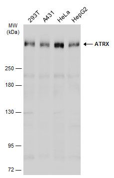 ATRX antibody [C3], C-term