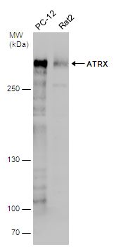ATRX antibody [C3], C-term