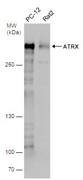 ATRX antibody