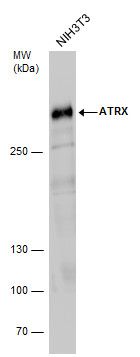 ATRX antibody