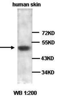 ADAMTS2 Rabbit Polyclonal Antibody